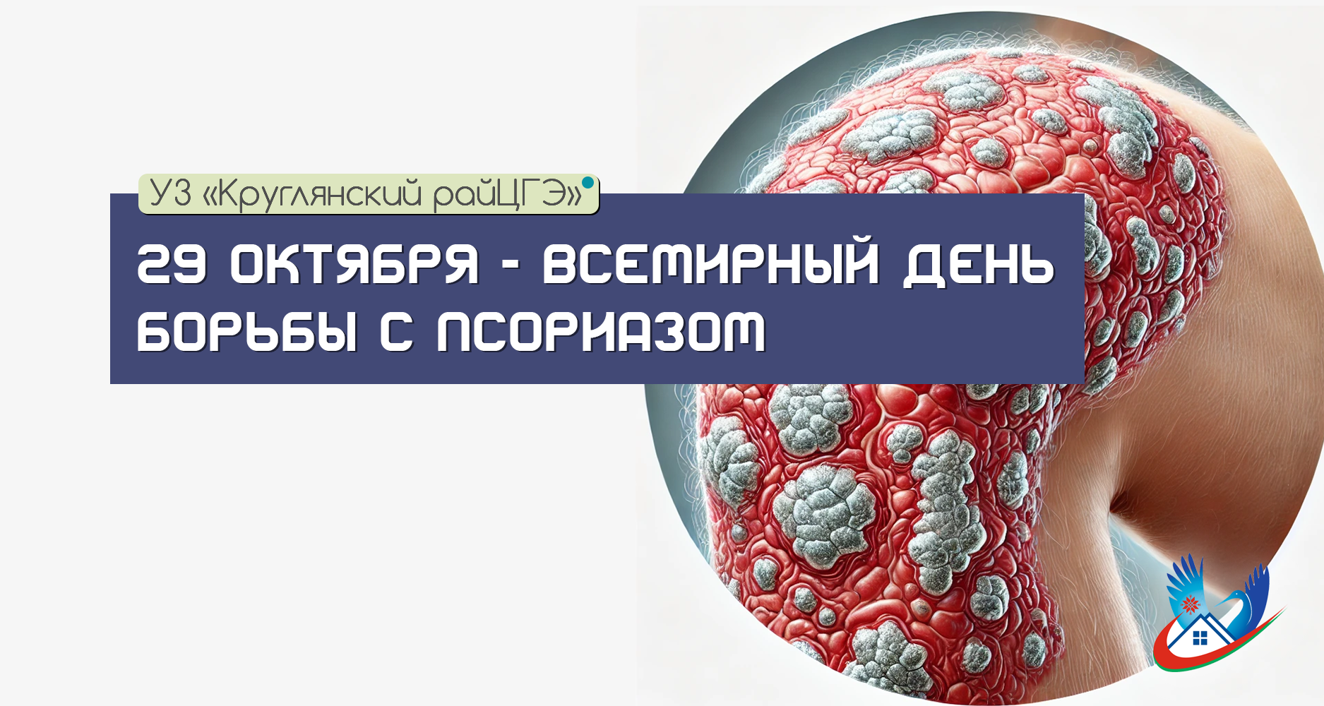 29 ОКТЯБРЯ — ВСЕМИРНЫЙ ДЕНЬ БОРЬБЫ С ПСОРИАЗОМ
