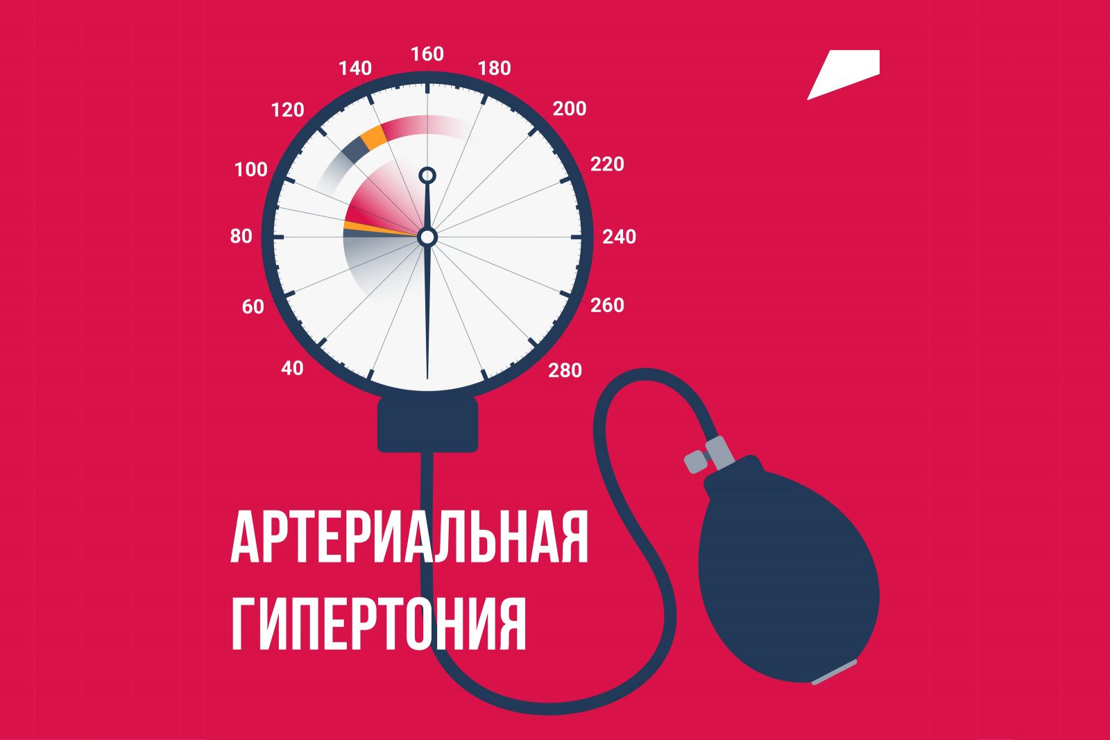 Артериальная гипертензия (гипертония)