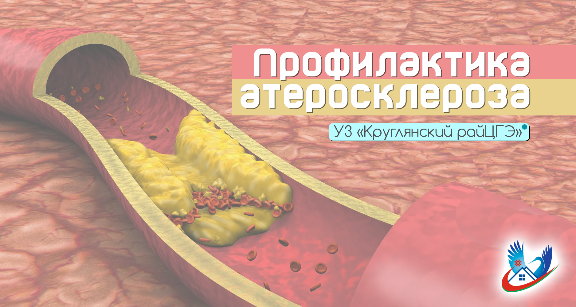 ПРОФИЛАКТИКА АТЕРОСКЛЕРОЗА